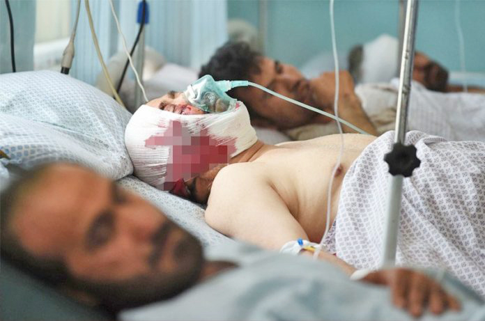Wounded Afghan men receive treatment at the Wazir Akbar Khan hospital following a car bomb attack in Kabul on July 1, 2019.
